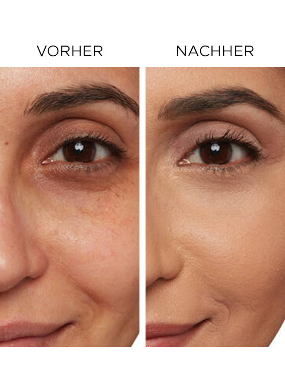 Bye Bye Under Eye Concealer Vorher/Nachher